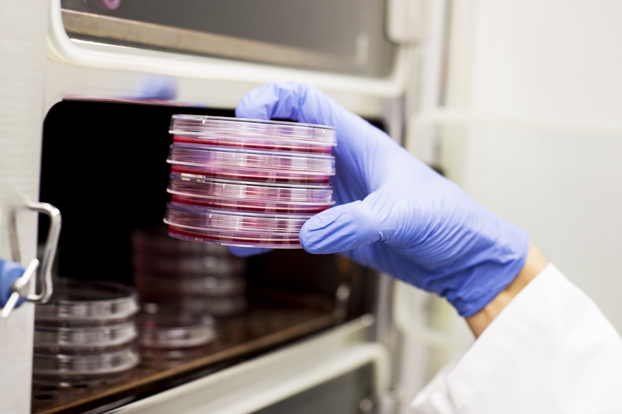 Multimillion-pound clinical trials 'mark new era for pancreatic cancer ...