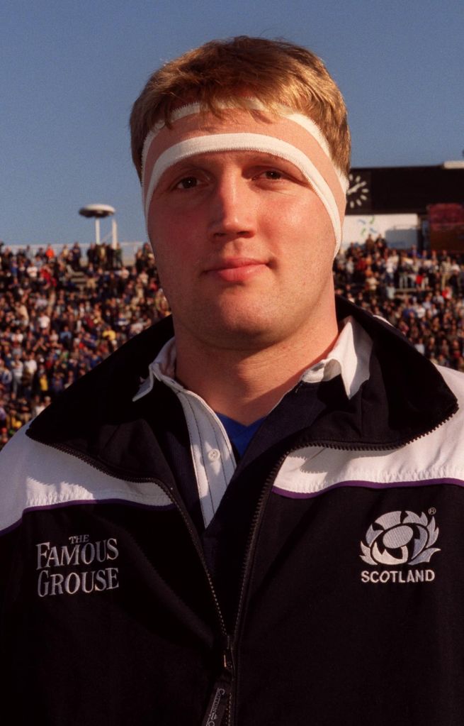 Scottish rubgy legend Doddie Weir has MND | News - Northsound 1