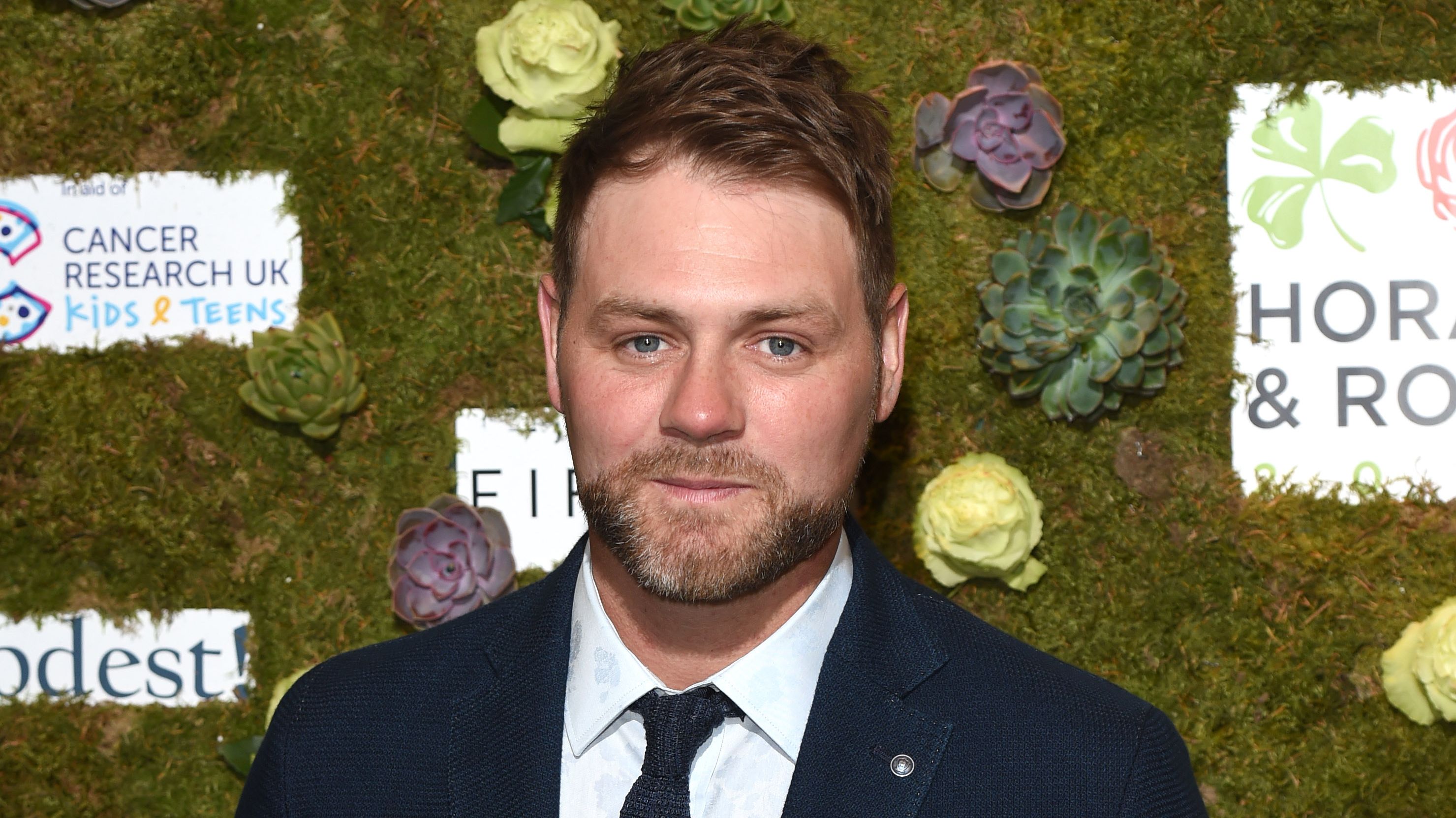 Former Westlife Singer Brian Mcfadden Reveals Result Of His Hair Transplant Celebrity Heat Radio Former Westlife Singer Brian Mcfadden Reveals Result Of His Hair Transplant Celebrity Heat Radio