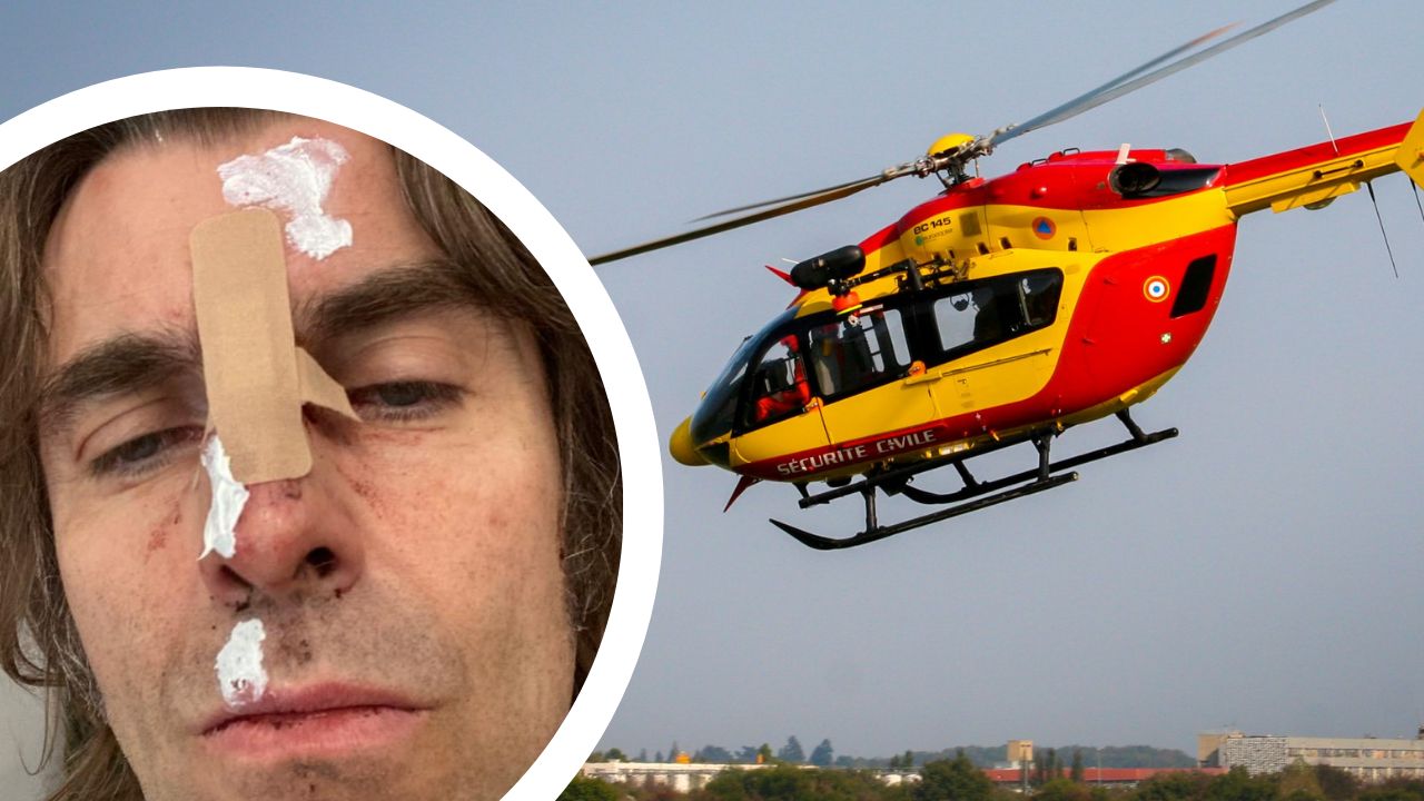 liam-gallagher-reveals-injuries-after-falling-out-of-a-helicopter