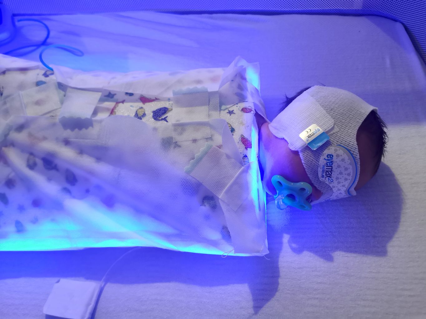 new-at-home-treatment-for-jaundice-in-herefordshire-news-free-radio