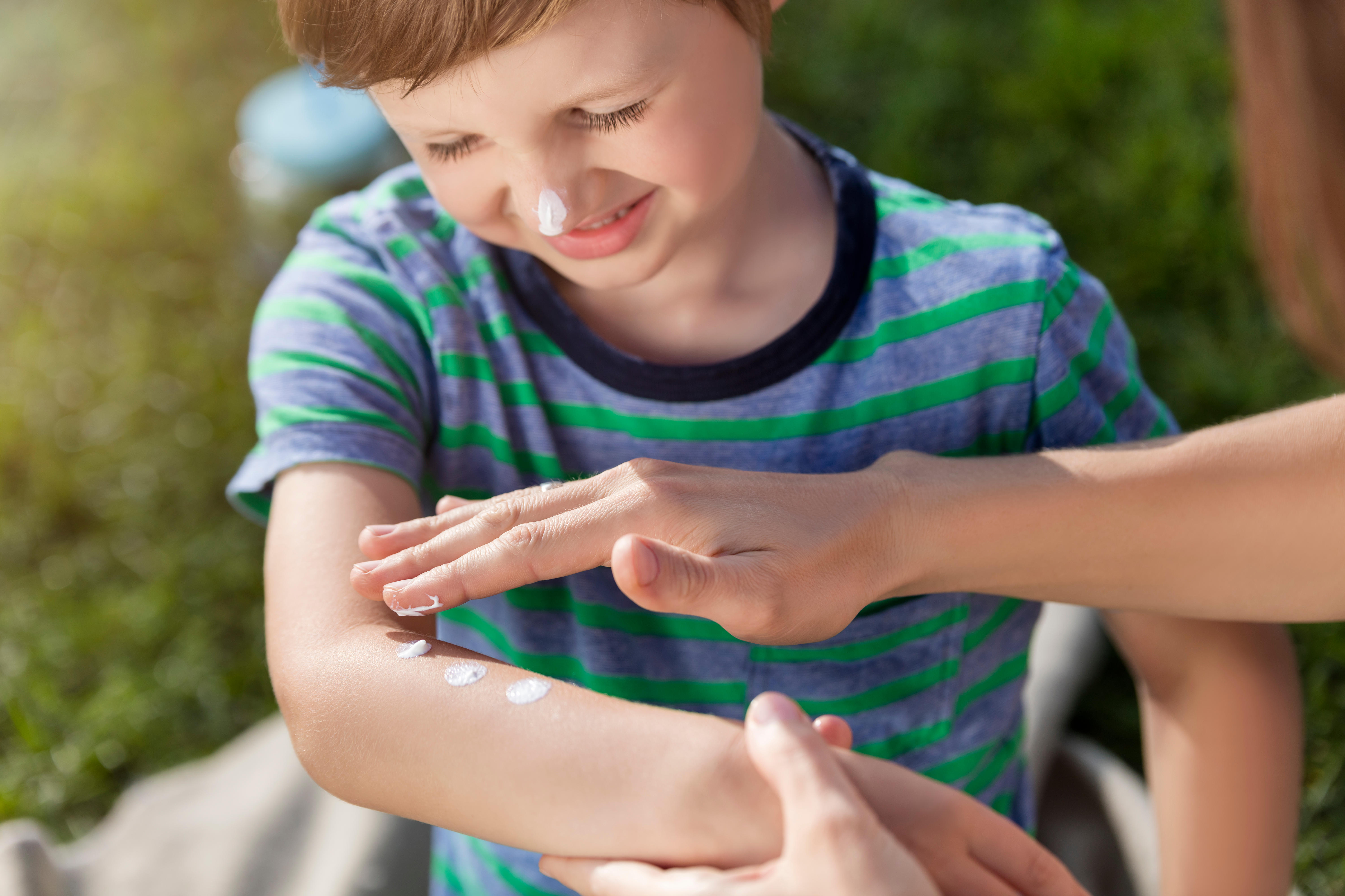 Wolverhampton community shop is calling for suncream to be affordable ...
