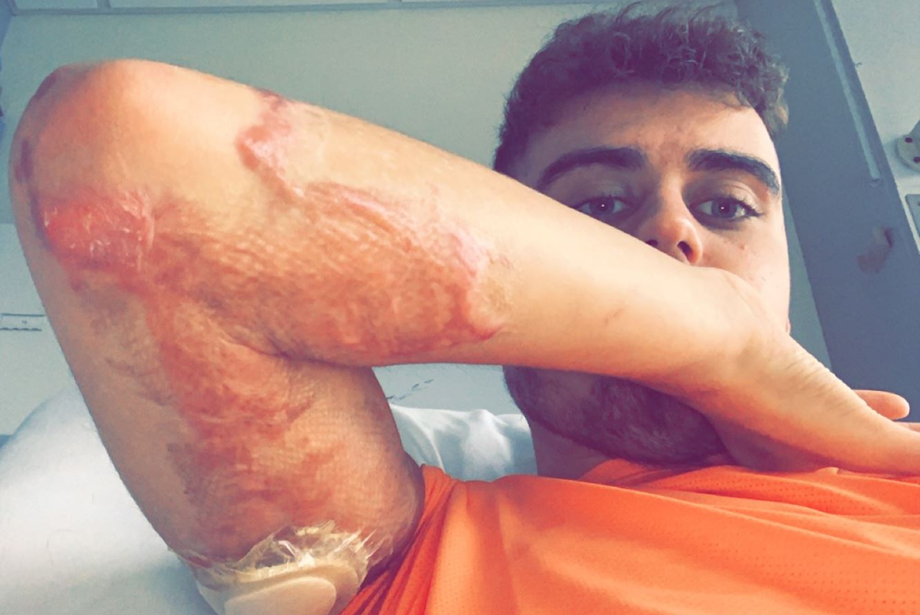 Fife dad, 25, buried in concrete suffers life-changing injuries