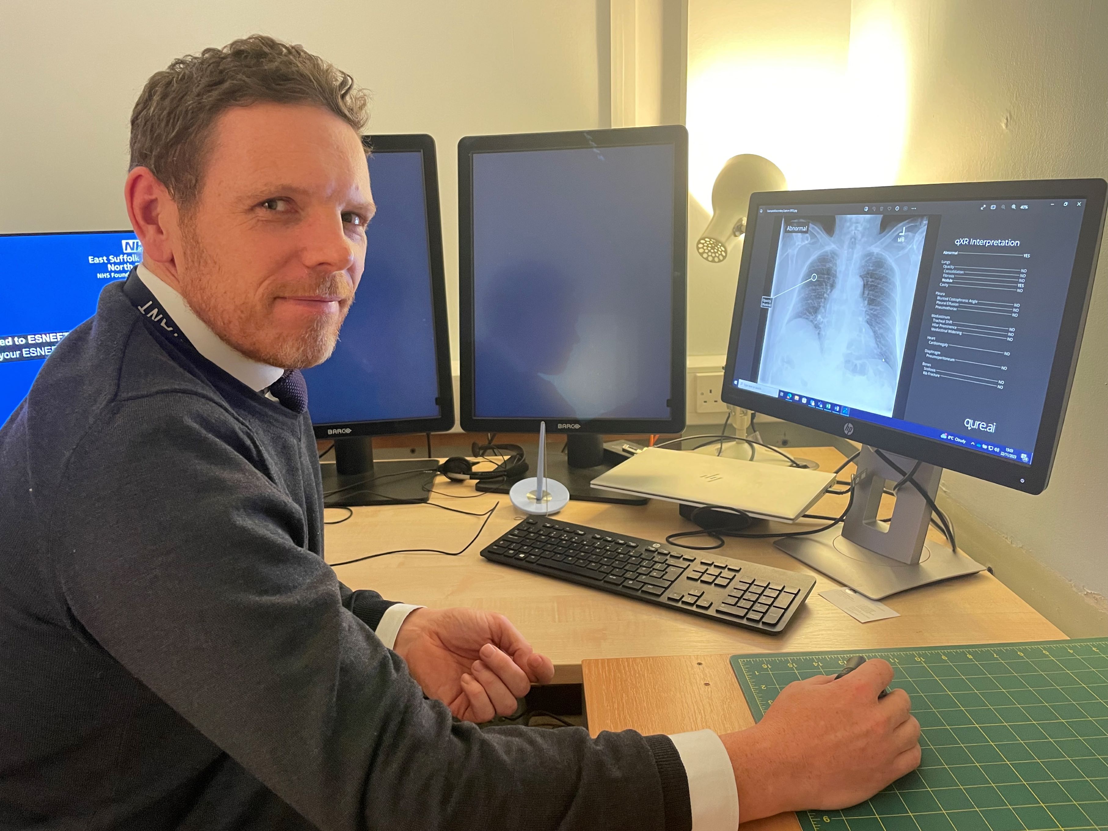 Ipswich Hospital takes part in study using AI to ‘read’ x-rays | News ...