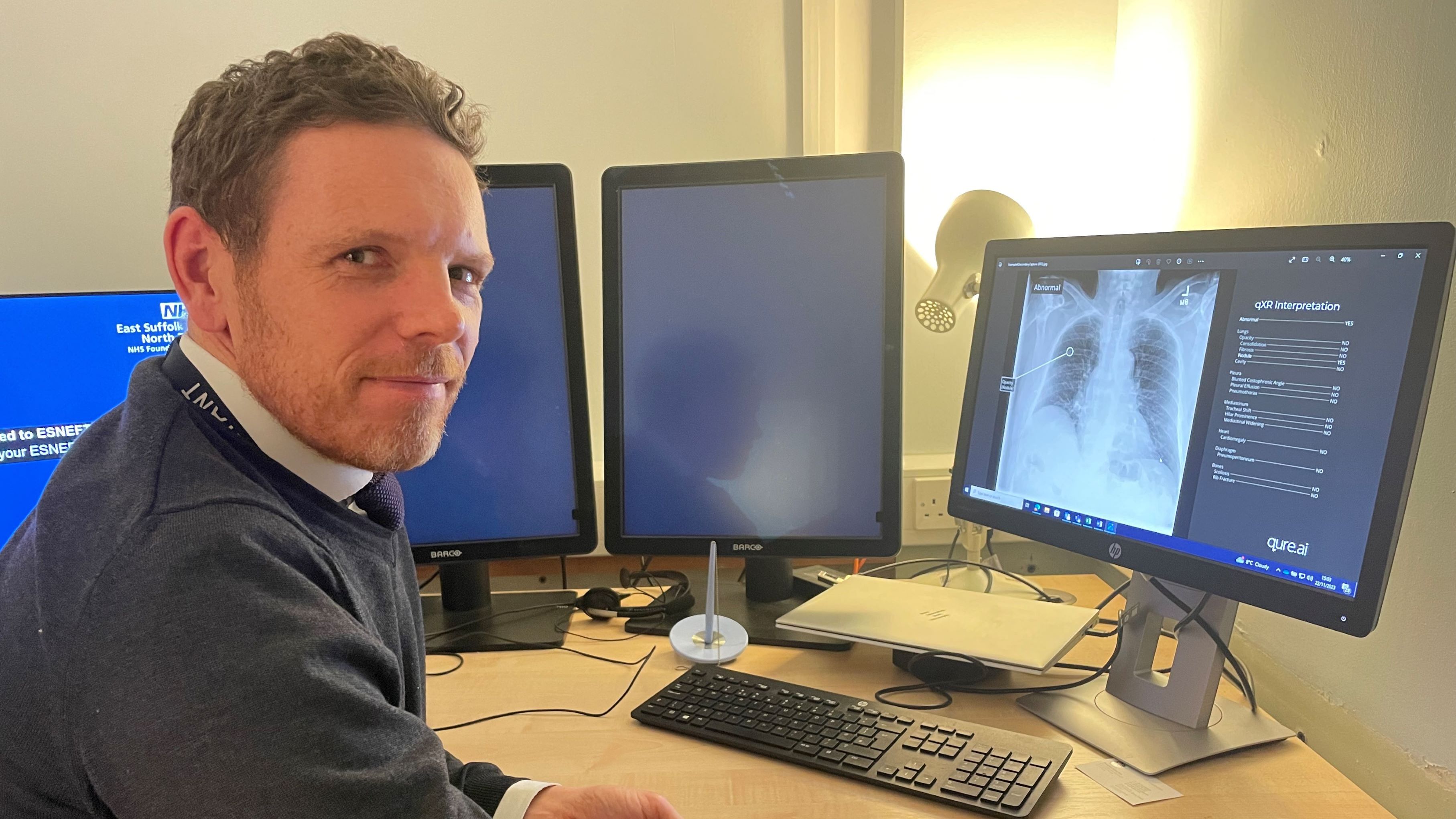 Andrew Ingham Radiologist Ipswich Hospital takes part in study using AI to ‘read’ x-rays | News ...