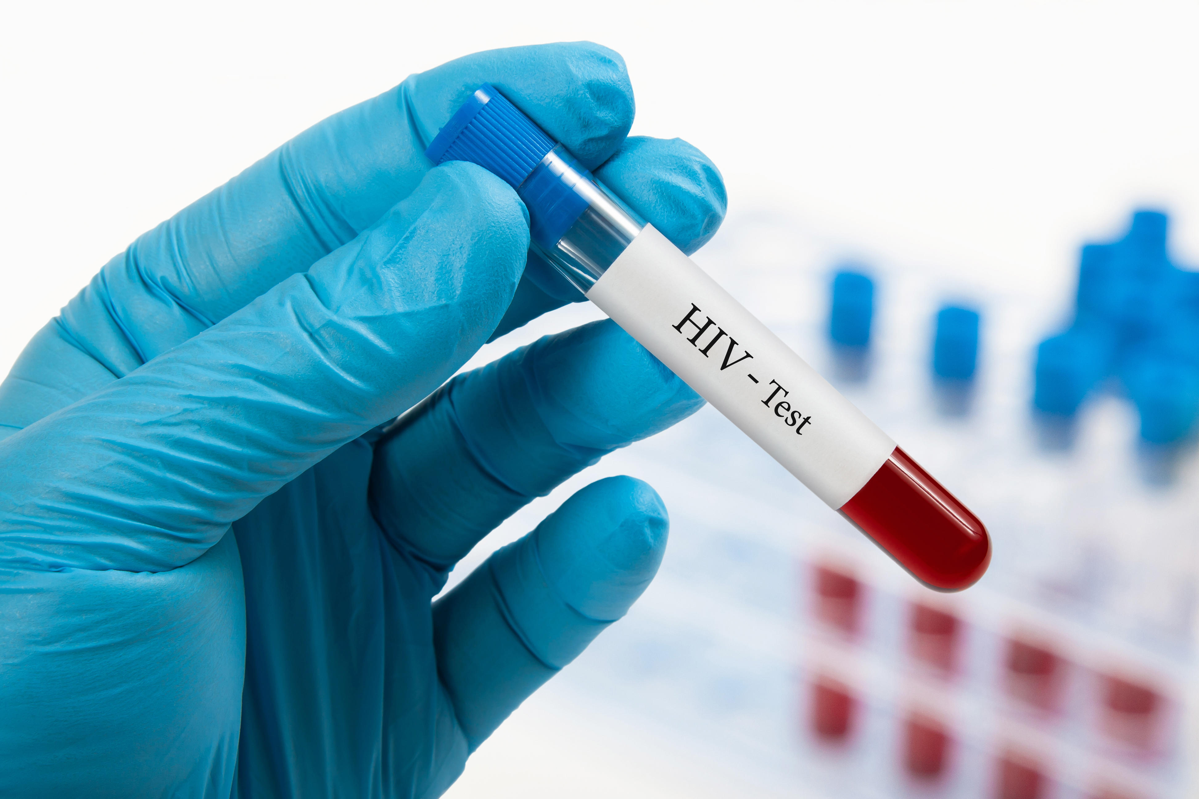 HIV Awareness Wiltshire encouraged to check sexual health