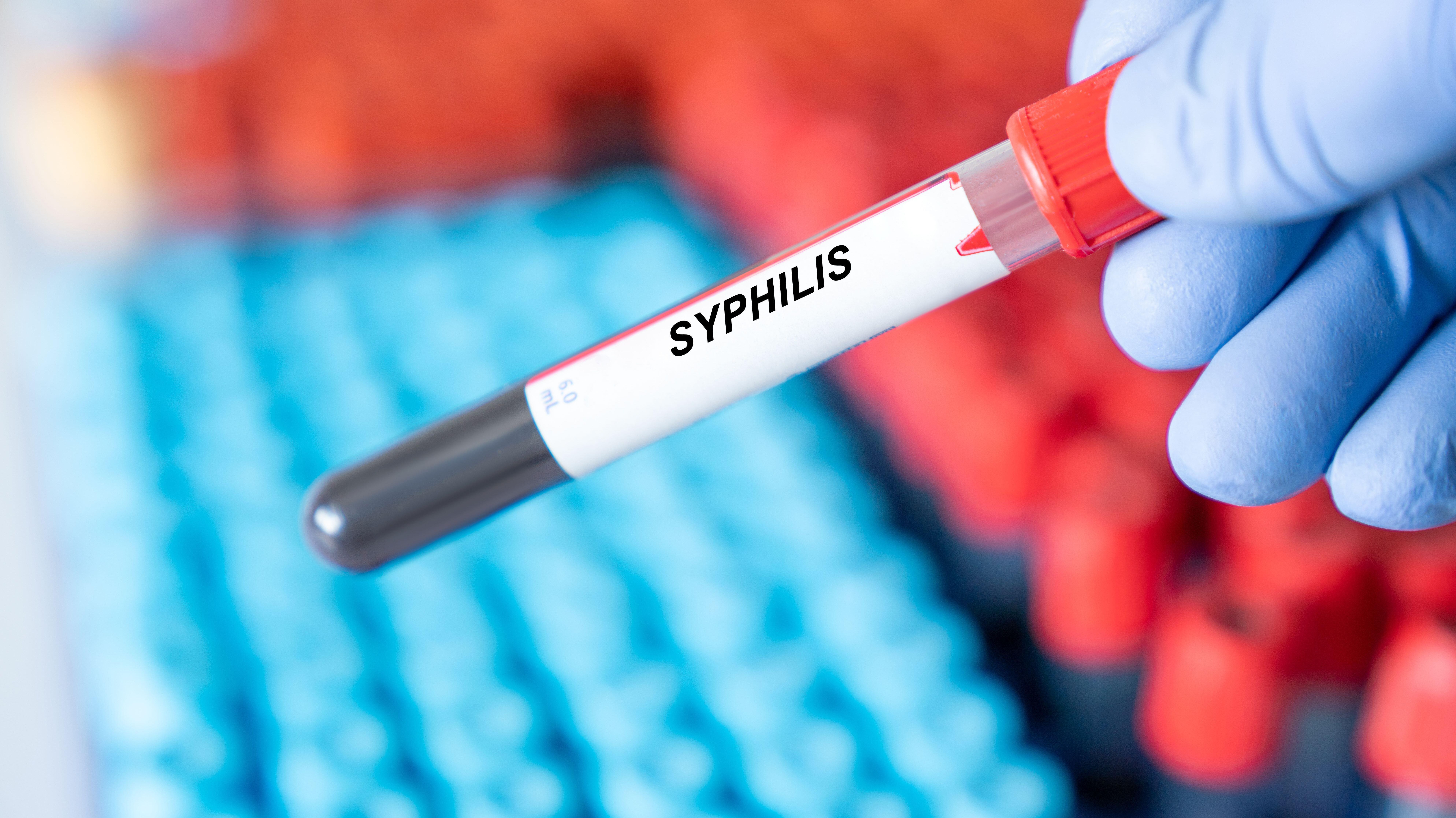Sypplis Health warning after