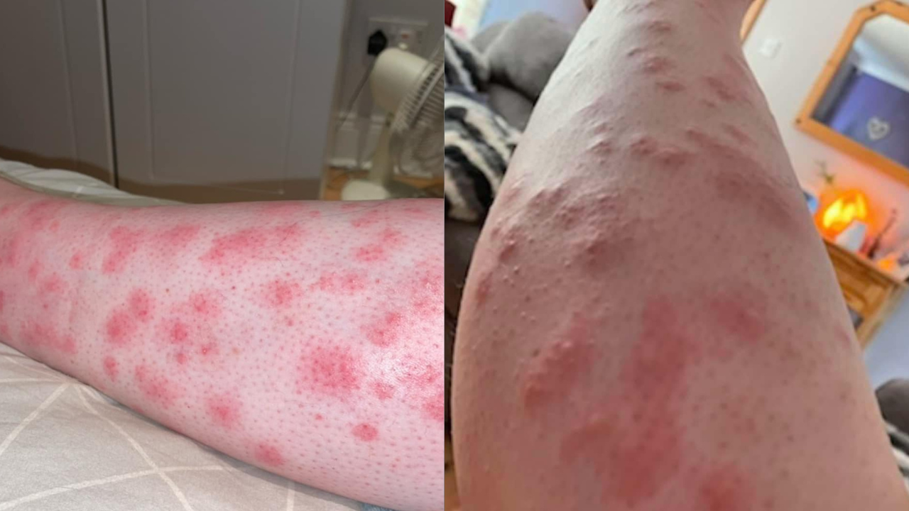 Ballykelly Bites: Investigation underway | News - Hits Radio