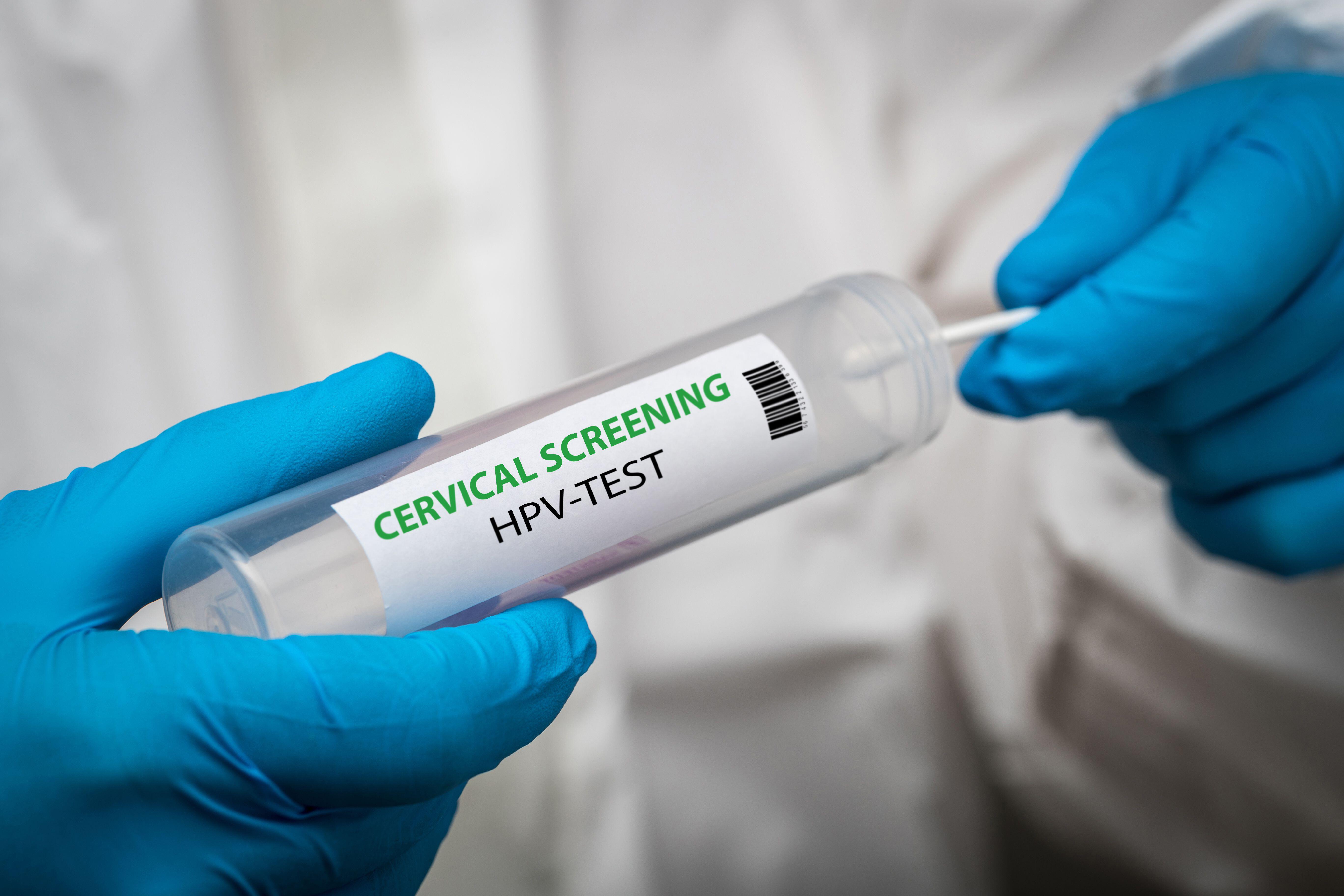 NI Screening body to consider recommendation that could allow for at ...