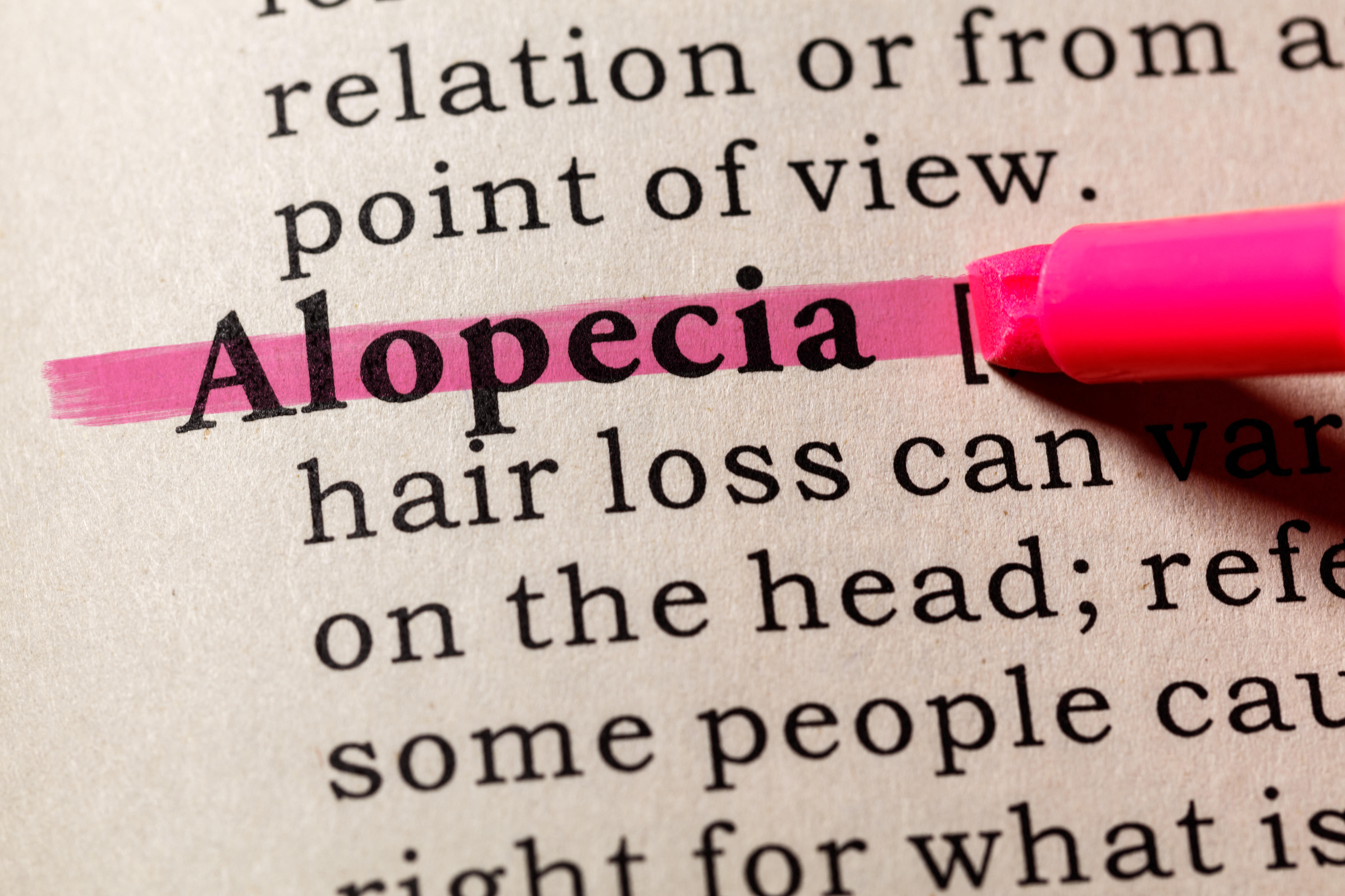 South Yorkshire mum-of-2 opens up about her alopecia journey