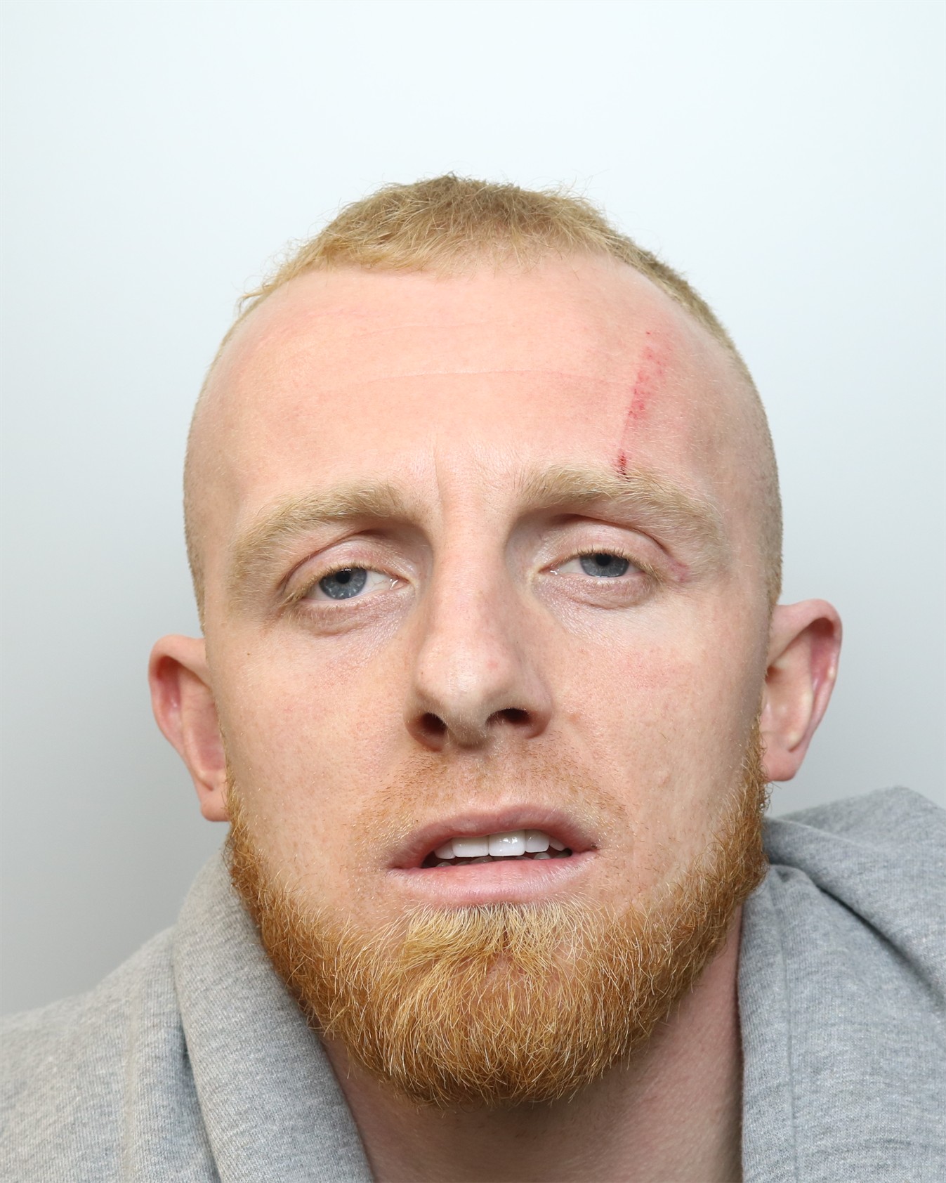 Man jailed for crypto-fuelled drug dealing in Scarborough | News ...
