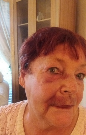 73 year-old Rochdale woman attacked outside her home | News - Greatest ...